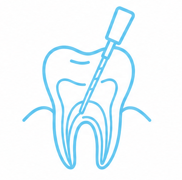 Root Canal Root Canal
